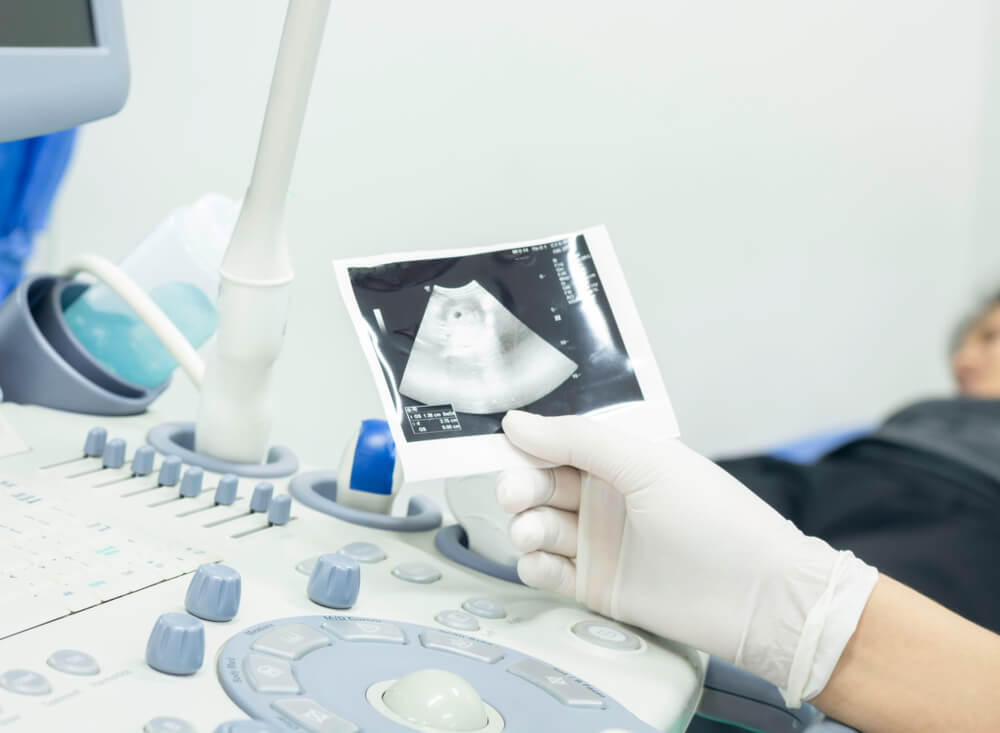 The Women Wore Gloves Are Watching the Ultrasound Abdomen of a Female Patient Lying on a Bed of the Hospital