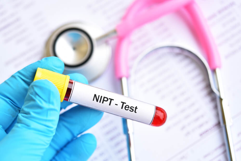 Blood Sample for NIPT or Non Invasive Prenatal Testing, Diagnosis for Fetal Down Syndrome in Pregnancy Woman