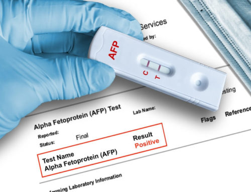 Alpha-Fetoprotein (AFP) Test in Prenatal Screening and Diagnosis