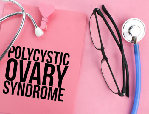 Everything You Should Know About PCOS (Polycystic Ovary Syndrome): Symptoms, Diagnosis, and Treatment Options