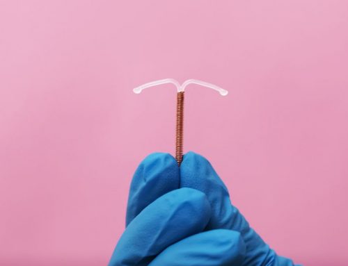 How Long Do IUDs Last? A Complete Guide to IUD Longevity, Safety, and What to Expect