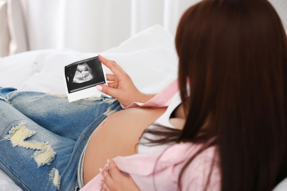 Pregnant woman with ultrasound picture