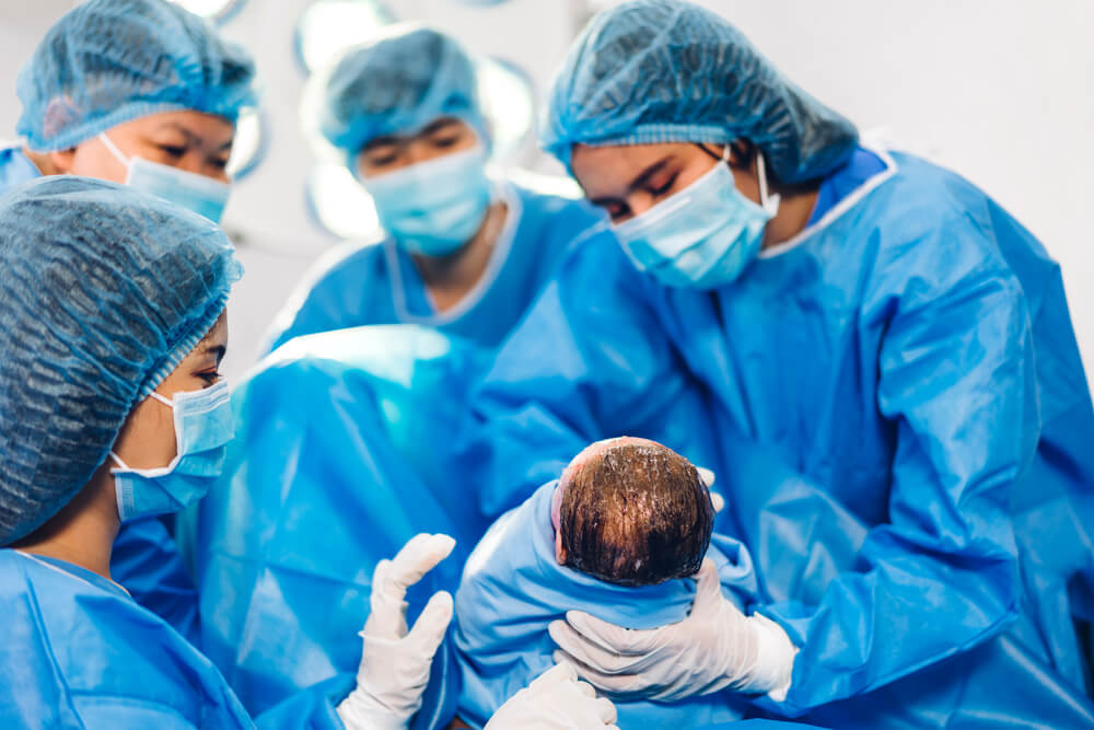 Professional Anesthesiologist Doctor Medical Team and Assistant Is Performing Baby Cesarean Section
