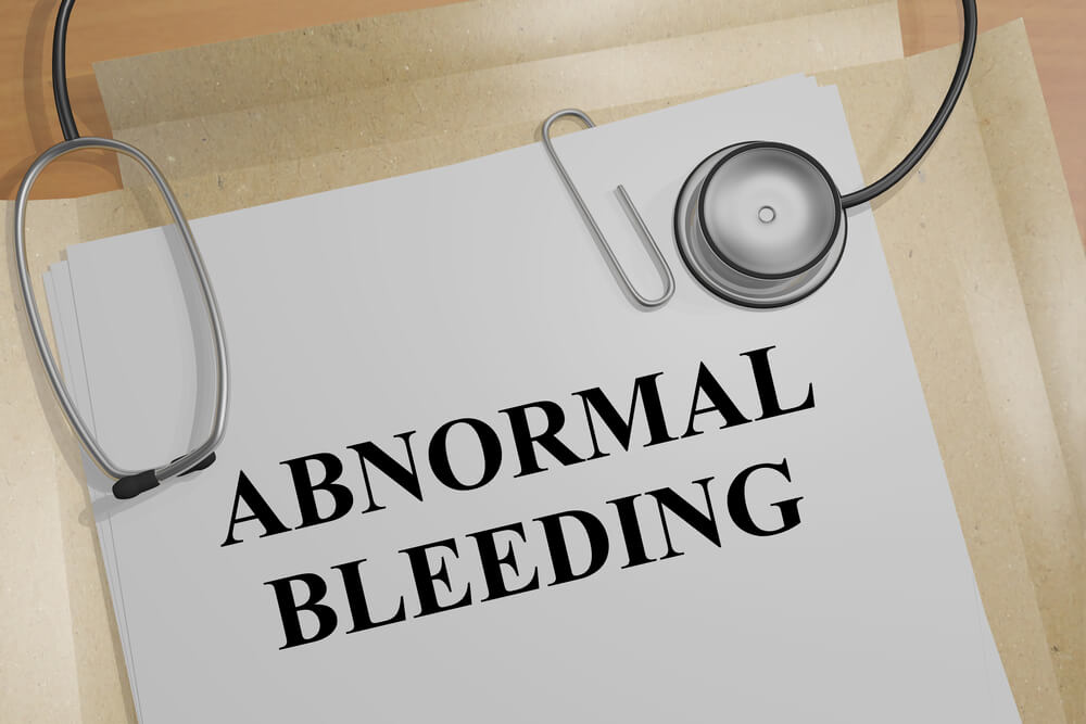 3d Illustration Of Abnormal Bleeding Title On A Medical Document