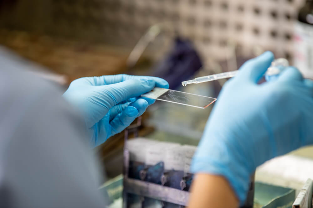 staining slide Pap smear for cytology,laboratory.