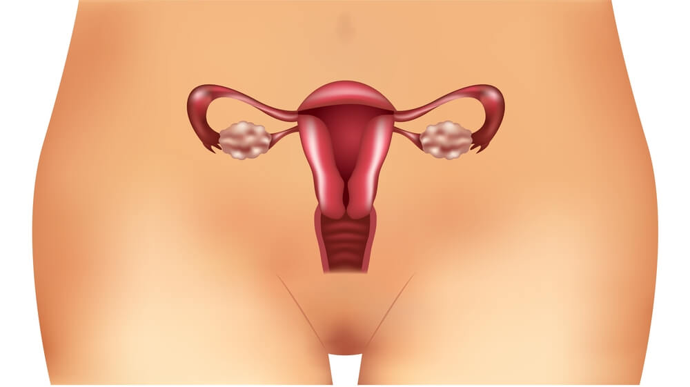 polycystic ovary syndrome