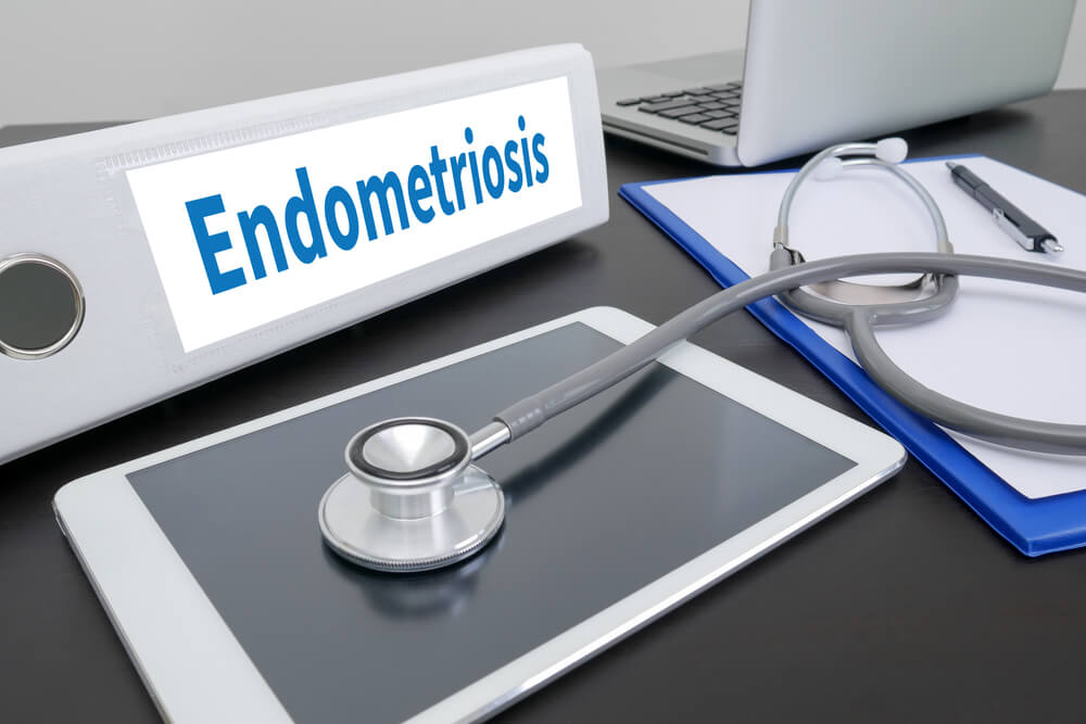 Endometriosis