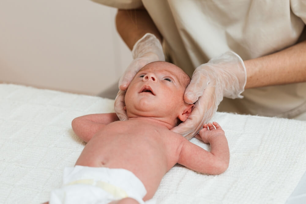 hysiotherapist Doing A Positional Plagiocephaly Correction On A Newborn Baby In A Therapy Center