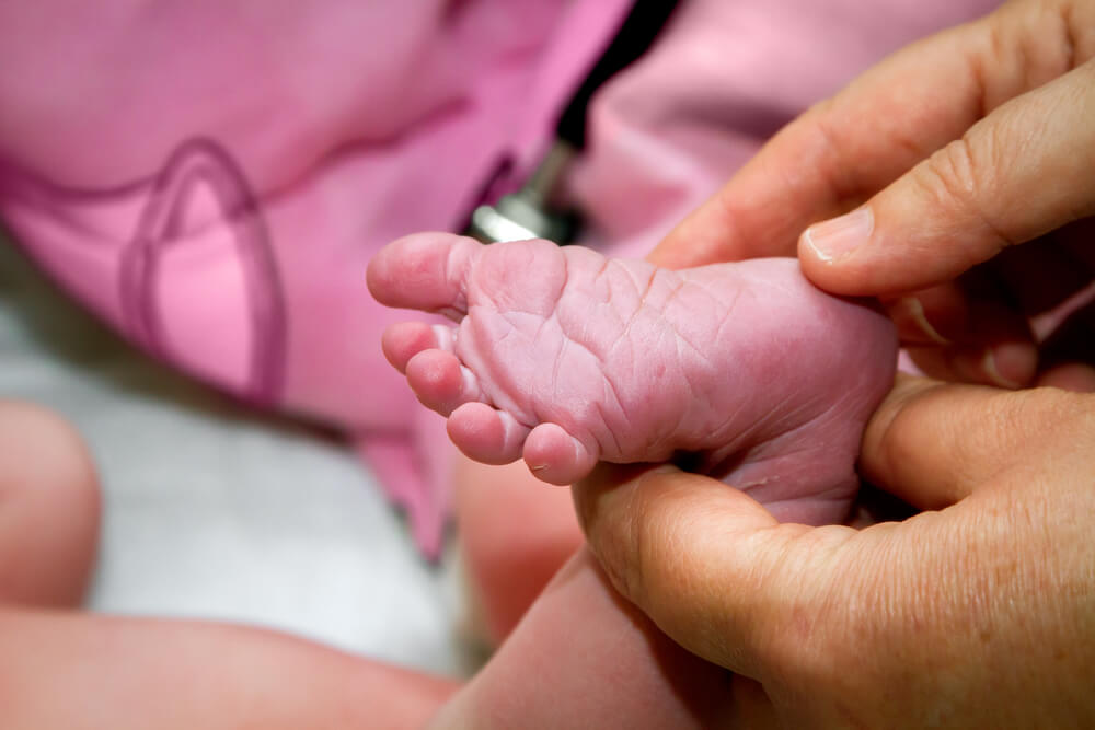 The hands of a midwife test the Babinski Reflex on the foot of a newborn.