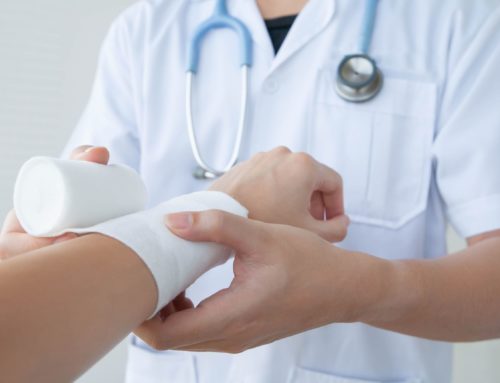 Treating Pain Caused by Burns