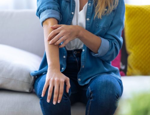 Psoriasis: Causes, Symptoms, and Treatments