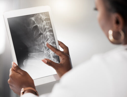 Are You at Risk for Osteoporosis?