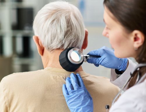 Detecting and Treating Skin Cancer: What Is Mohs Surgery?